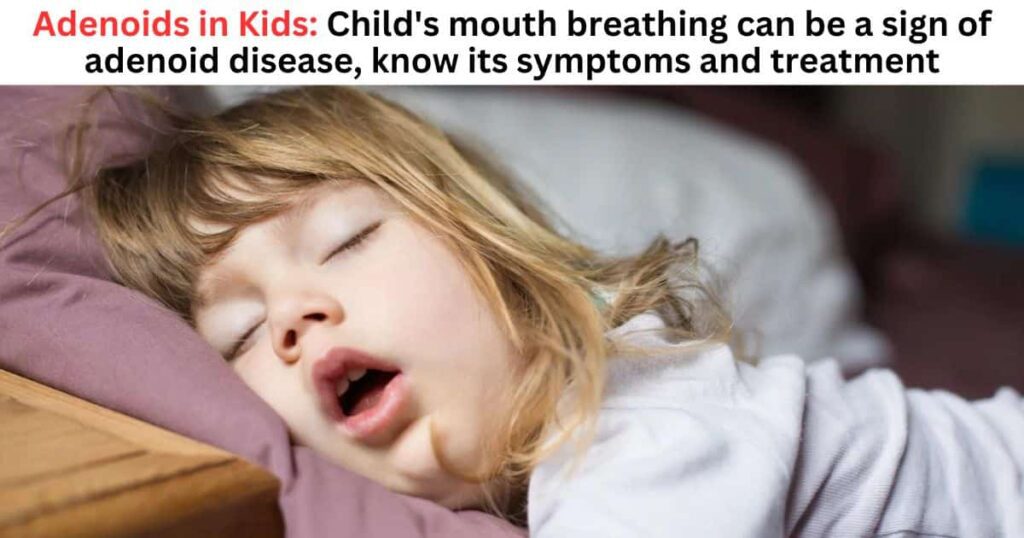 Adenoids in Kids: Child’s mouth breathing can be a sign of adenoid ...